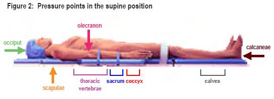 Patient Positioning Guidelines: Supine Position